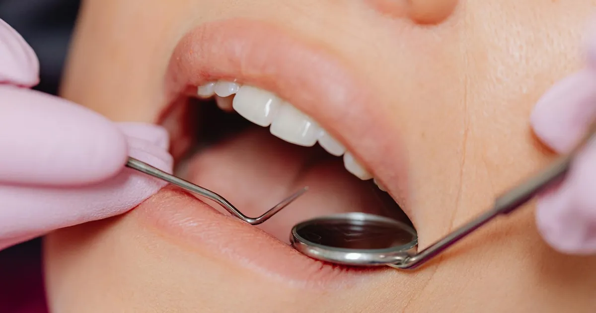 Close-up of a dental examination using dental tools for hygiene and care.