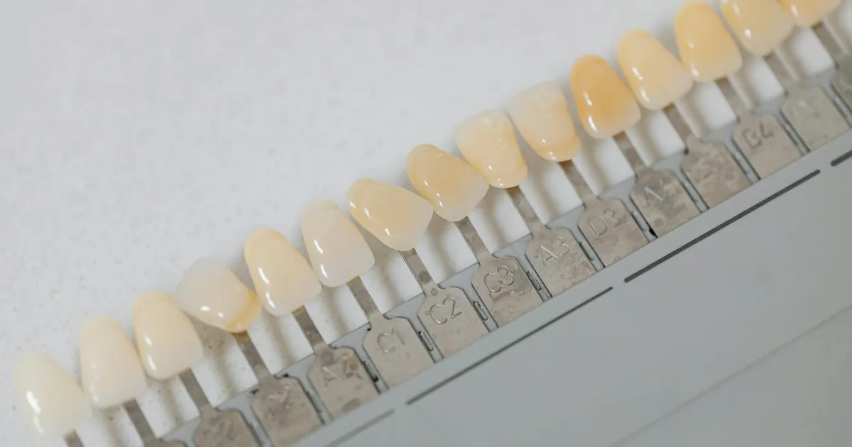 Close-up of a dental shade guide used for tooth color matching in dentistry.