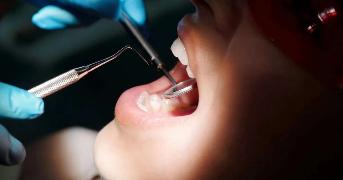 Detailed close-up of a dental check-up with tools and patient under bright light.