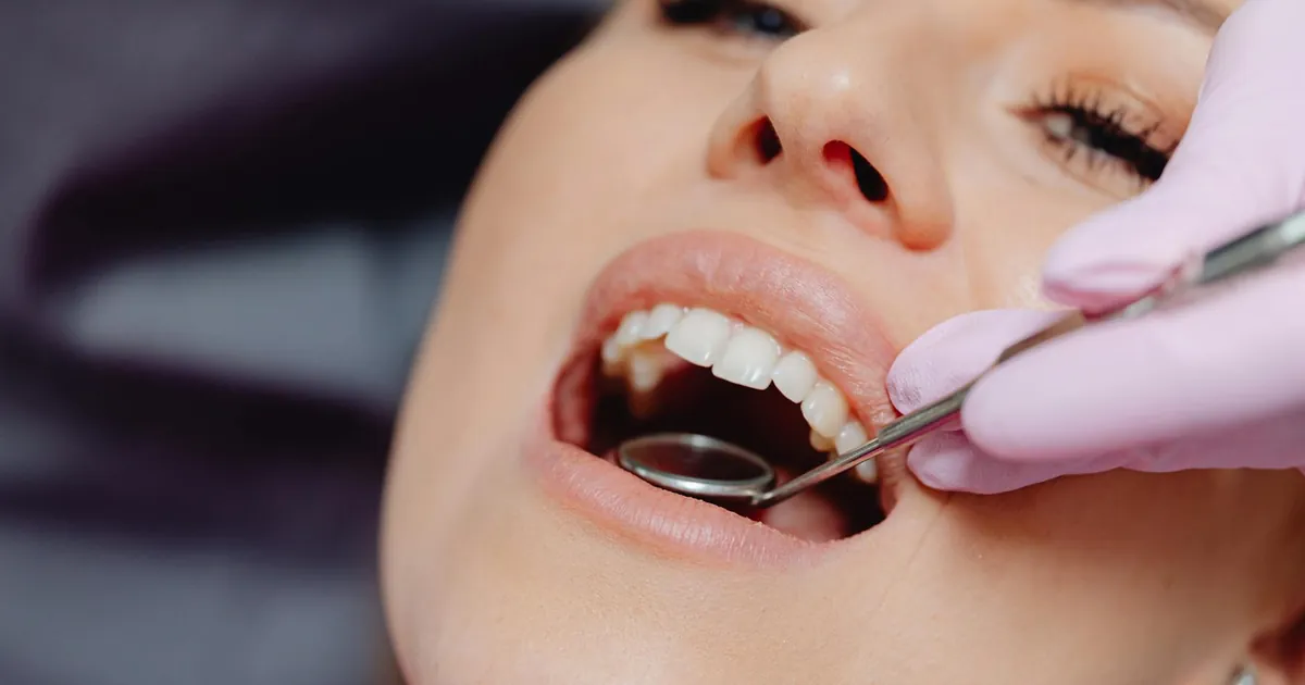 Close-up of a patient getting a dental checkup with dental tools in use.