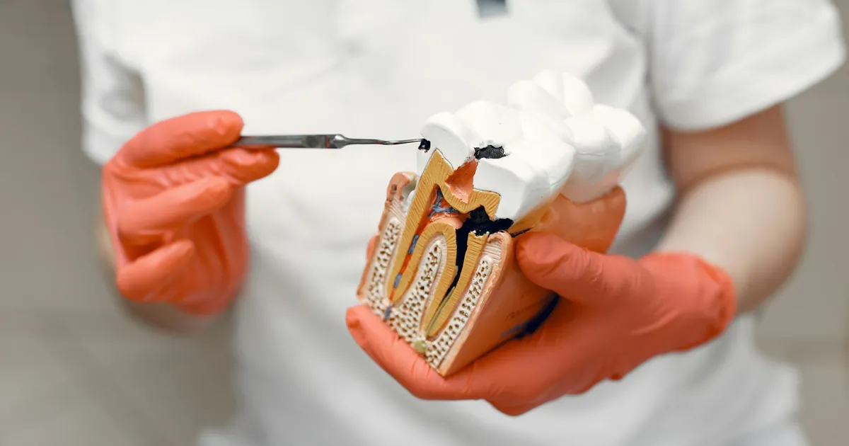 Close-up of dentist holding a tooth model, illustrating dental care concepts.