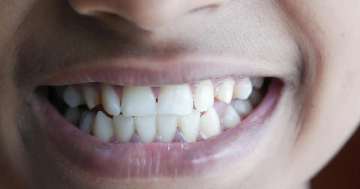 Close-up image of a person's smile highlighting teeth and lips, vibrant and cheerful.