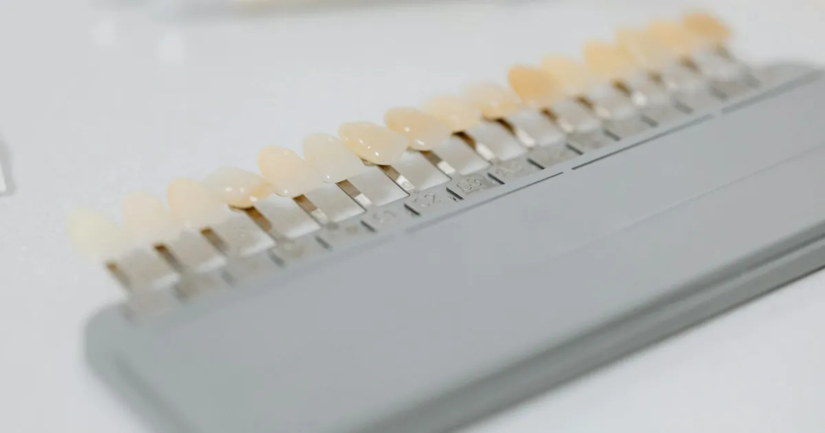 Close-up image of a dental shade guide displaying various tooth color options.