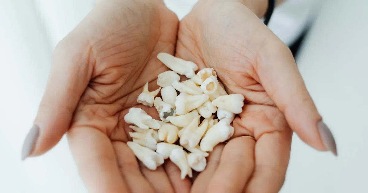 Close-up of hands gently holding a collection of human teeth, symbolizing dental health and care.