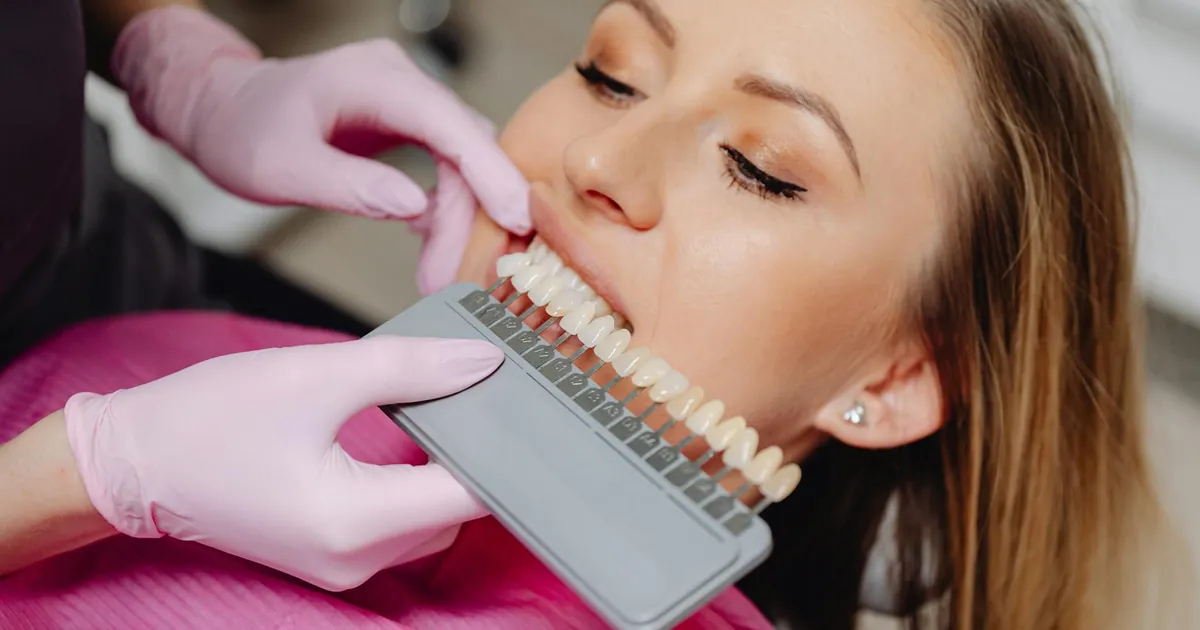 Dental shade guide being used to match tooth color during a hygiene procedure.