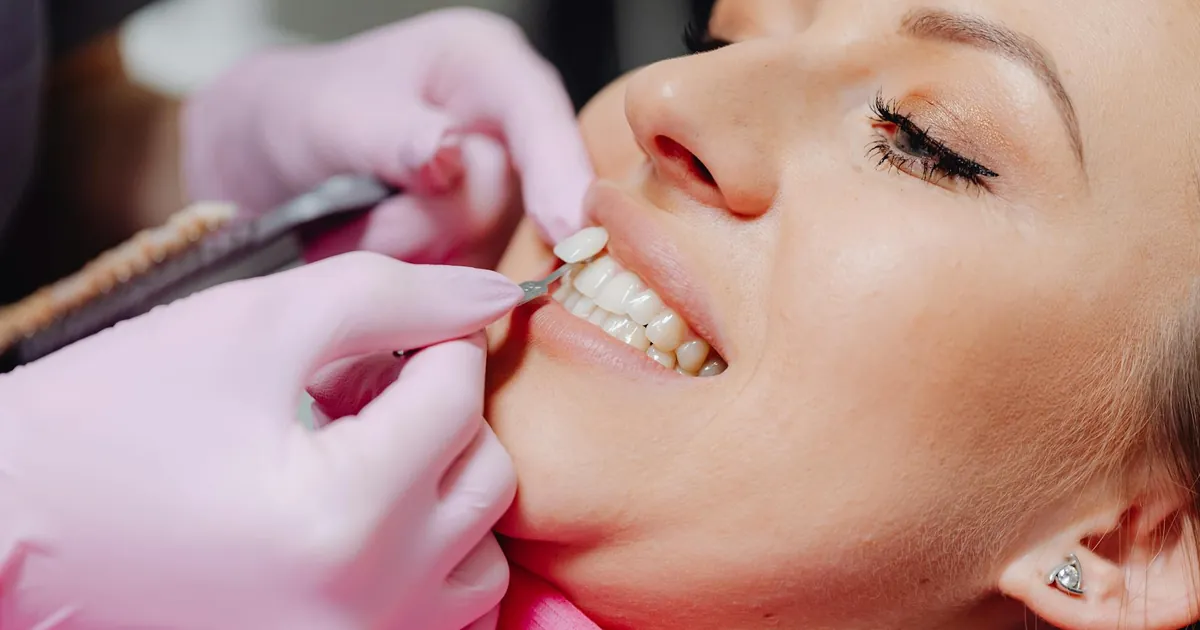 A close-up of a woman receiving dental veneers, showcasing detail and precision.