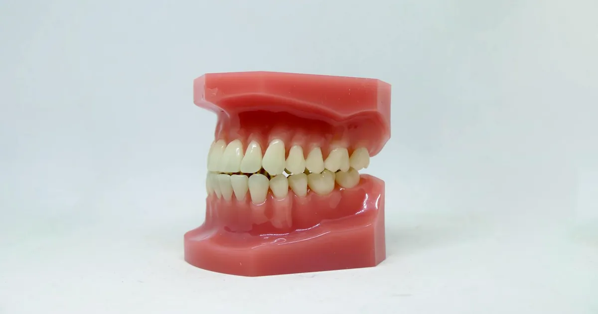 A dental model showcasing human teeth used for orthodontic purposes on a white background.