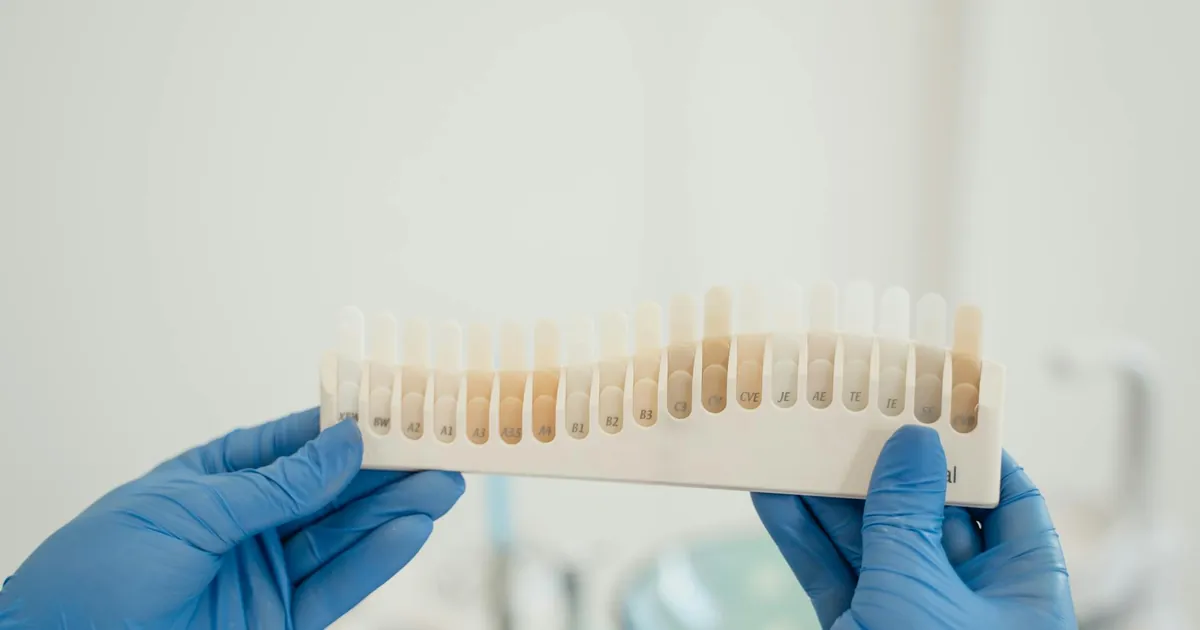 Dentist using a tooth shade guide to match patient's tooth color accurately during treatment.