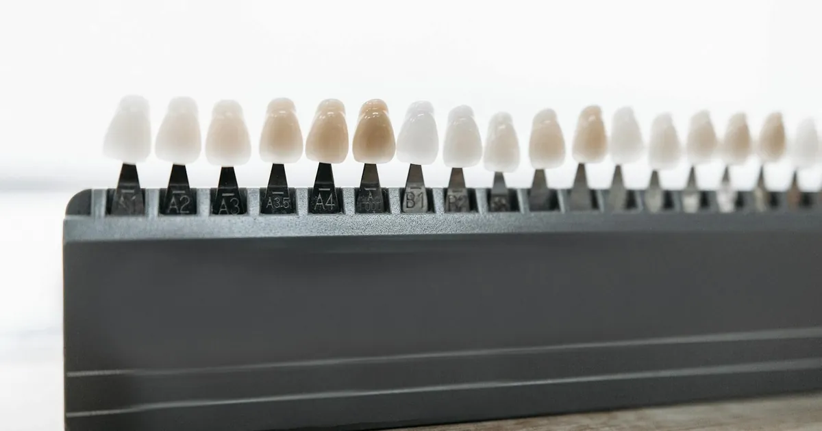 Detailed view of dental veneer shade guide for matching tooth color.