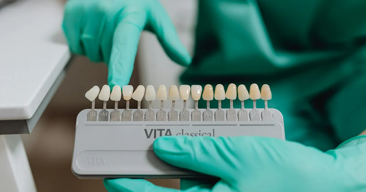 Close-up of dentist using a tooth shade guide for accurate dental matching in clinic.