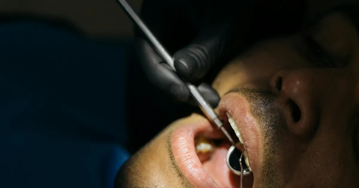 Detailed close-up of a dental examination with instruments in a clinical setting.