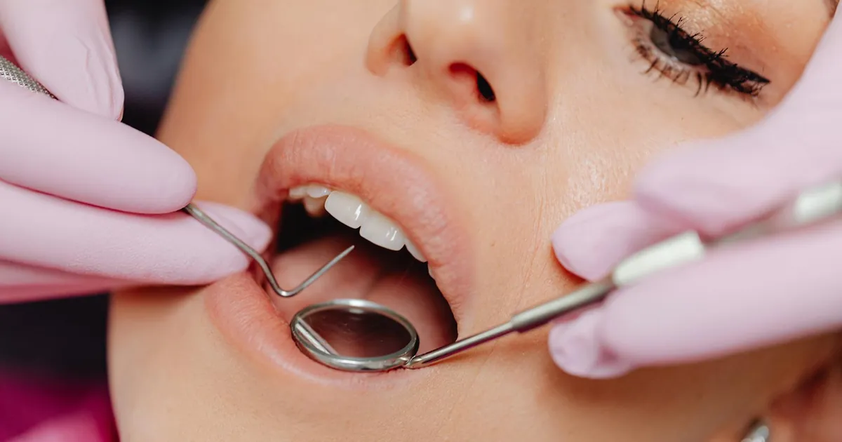 Close-up of a woman's dental checkup with a dentist using tools in a clinic.